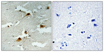 FoxO4 (phospho Ser197) rabbit pAb Antibody