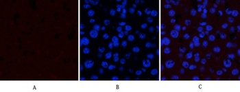GSK3α/β (phospho Tyr279/216) rabbit pAb Antibody