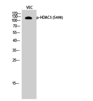 HDAC5 (phospho Ser498) rabbit pAb Antibody
