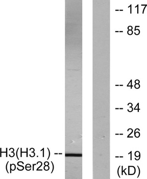 Histone H3 (phospho Ser28) rabbit pAb Antibody