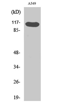 Hrs (phospho-Tyr216) antibody