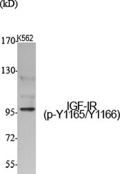 IGF-IR (phospho Tyr1165/Y1166) rabbit pAb