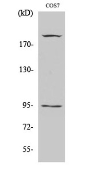 IGF-IR (phospho Tyr1165/Y1166) rabbit pAb Antibody
