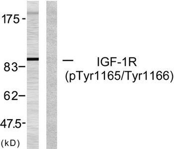 IGF-IR (phospho Tyr1165/Y1166) rabbit pAb Antibody