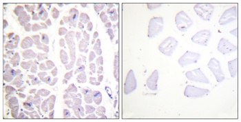 IKKα/β (phospho Ser180/181) rabbit pAb Antibody