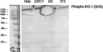 IRS-1 (phospho-Ser636) antibody