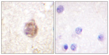 IRS-1 (phospho Ser794) rabbit pAb
