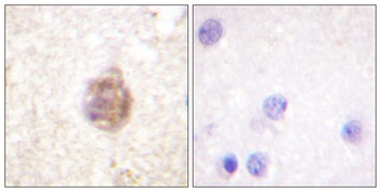 IRS-1 (phospho-Ser794) antibody