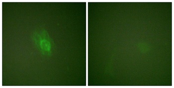 IκB-β (phospho Ser23) rabbit pAb Antibody