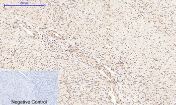 NFκB-p65 (phospho Ser276) rabbit pAb