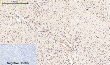 NF kappa B-p65 (phospho-Ser276) antibody