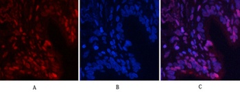 NF kappa B-p65 (phospho-Ser529) antibody