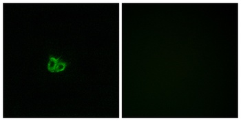Op18 (phospho Ser16) rabbit pAb Antibody