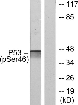 p53 (phospho Ser46) rabbit pAb Antibody