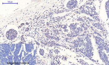 p53 (phospho Thr18) rabbit pAb Antibody