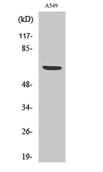 p70 S6 kinase alpha (phospho-Ser447) antibody