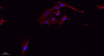 Tau (phospho Ser396) rabbit pAb