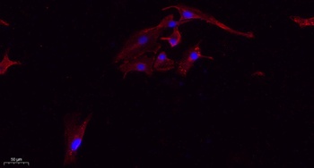 Tau (phospho-Ser396) antibody