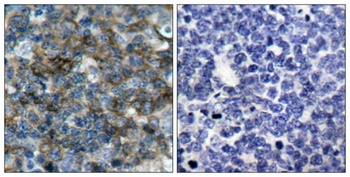 VASP (phospho Ser157) rabbit pAb Antibody
