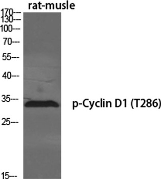 Cyclin D1 (phospho-Thr286) antibody