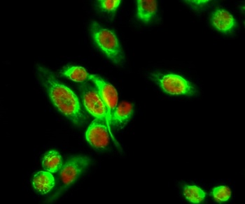 Smad3 (phospho Ser204) rabbit pAb