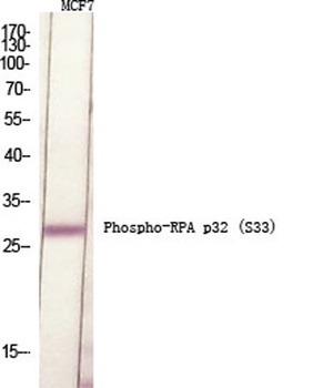 RPA p32 (phospho-Ser33) antibody