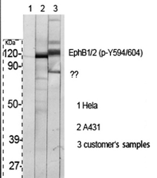 EphB1/2 (phospho Tyr594/604) rabbit pAb