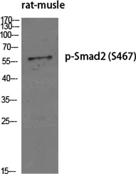 Smad2 (phospho Ser467) rabbit pAb