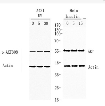 Akt (phospho-Thr308) antibody