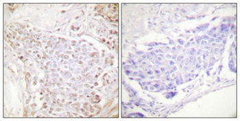 NFκB-p105/p50 (phospho Ser337) rabbit pAb Antibody