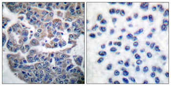eEF2K (phospho Ser366) rabbit pAb Antibody