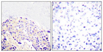 PLC γ1 (phospho Tyr771) rabbit pAb Antibody