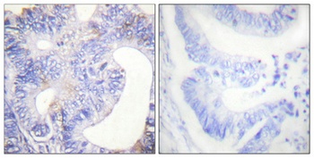 PLC γ2 (phospho Tyr753) rabbit pAb Antibody