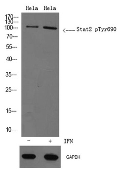 Stat2 (phospho Tyr690) rabbit pAb