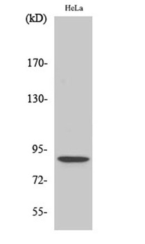 Stat5 (phospho-Ser726/731) antibody