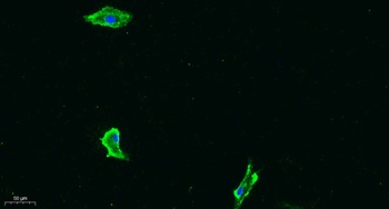 Flt-1 (phospho Tyr1333) rabbit pAb