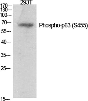 p63 (phospho-Ser455) antibody