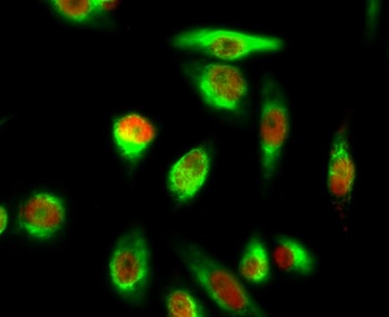 YAP (phospho Ser127) rabbit pAb
