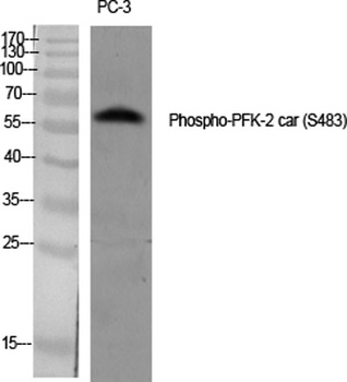 PFK-2 car (phospho-Ser483) antibody