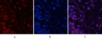 JNK1/2/3 (phospho Tyr185) rabbit pAb Antibody