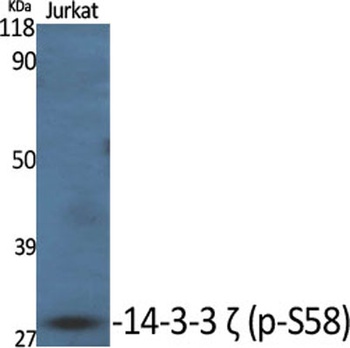 14-3-3 zeta (phospho-Ser58) antibody