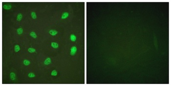 MEF-2 (phospho Ser408) rabbit pAb Antibody