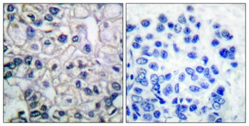 IGF-IR (phospho Tyr1161) rabbit pAb