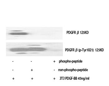 PDGFR-β (phospho Tyr1021) rabbit pAb