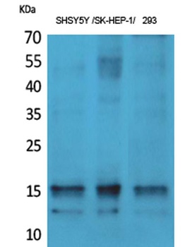 Synuclein-alpha (phospho-Tyr125) antibody