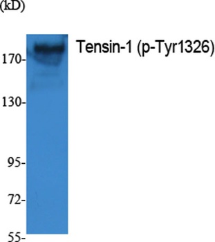 Tensin-1 (phospho-Tyr1326) antibody