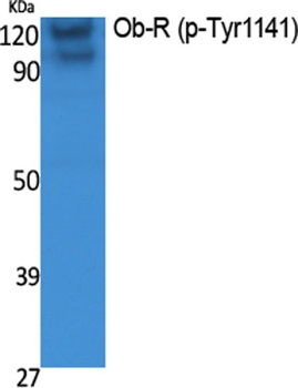 Ob-R (phospho Tyr1141) rabbit pAb