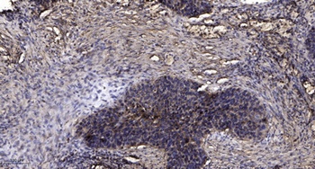 MLK3 (phospho Ser674) rabbit pAb Antibody