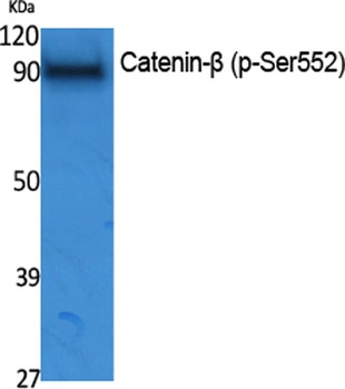 Catenin-beta (phospho-Ser552) antibody