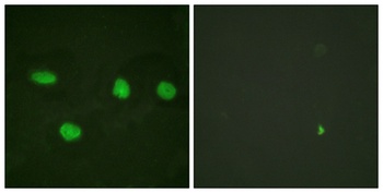 53BP1 rabbit pAb Antibody